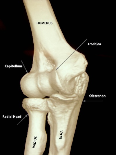 Radial head fracture - ElbowDoc